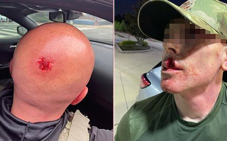 Sanctuary politicians' rhetoric led to 1,150% surge in violence against ICE agents: DHS