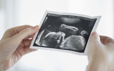 Scotland May Soon Allow Abortions Up To Birth For ‘Social Reasons’