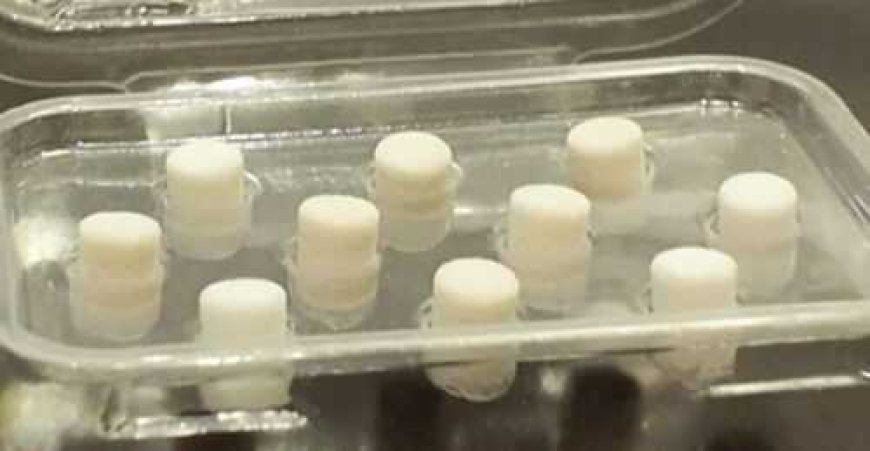 Coral from the sea is being used in some knee surgeries in NYC. Here's how, and why